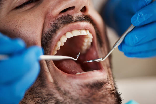 Best Emergency Denture Repair in Cabin John, MD